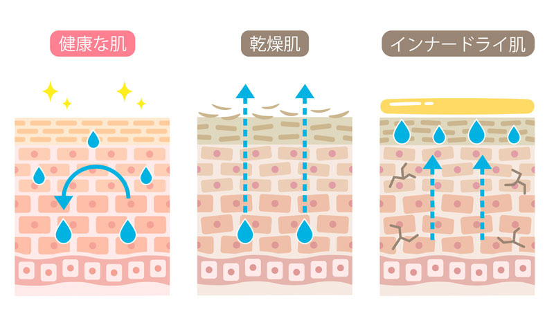 健康な肌、乾燥肌、インナードライ肌