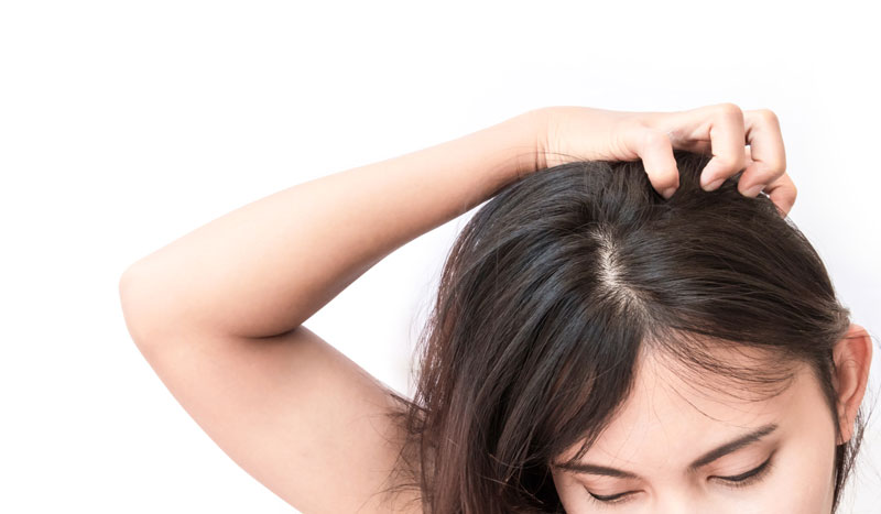 冬のヘアケアは皮脂の取りすぎにご注意を