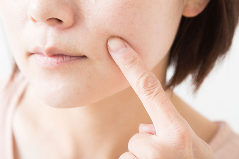 インナードライ肌の原因とは